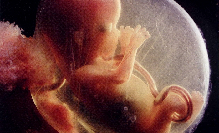 Foetus-avortement